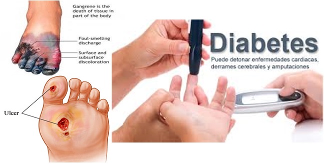 tipe-penyakit-diabetes-melitus